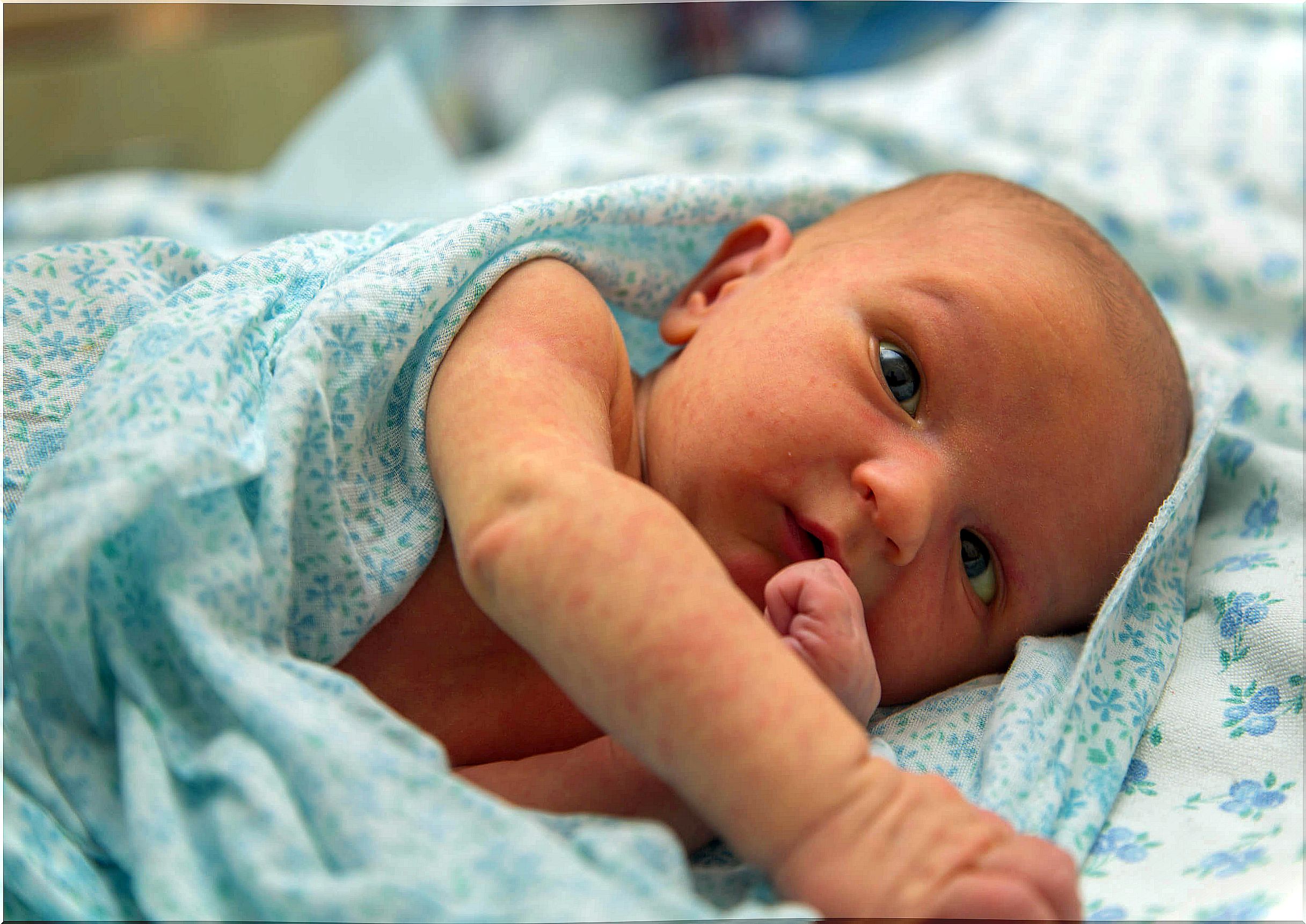 Newborn with pimples on his face.