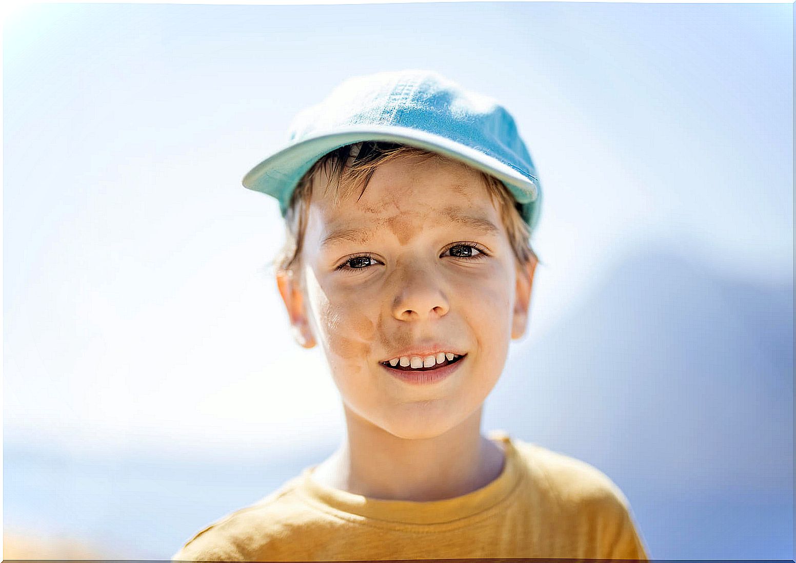 Child with pityriasis alba protecting himself from the sun with a cap.