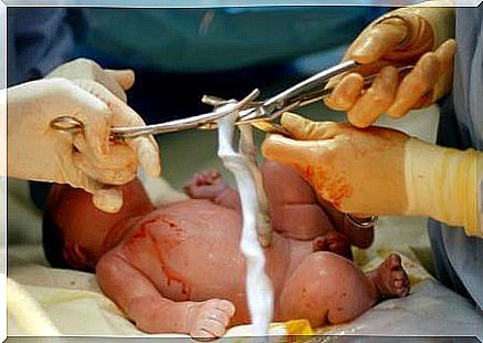 umbilical cord